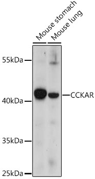 CCKAR Polyclonal Antibody