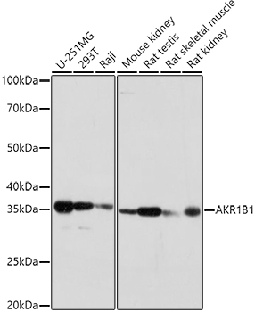 AKR1B1 Polyclonal Antibody