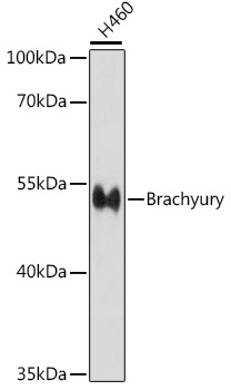 Brachyury Polyclonal Antibody