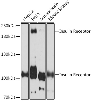 Insulin Receptor Polyclonal Antibody
