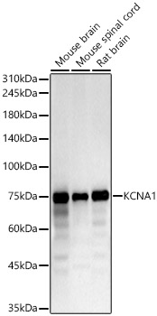 KCNA1 Polyclonal Antibody