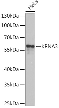 KPNA3 Polyclonal Antibody