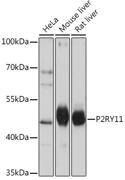 P2RY11 Polyclonal Antibody