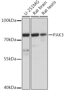 PAK3 Polyclonal Antibody