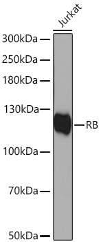 RB Polyclonal Antibody
