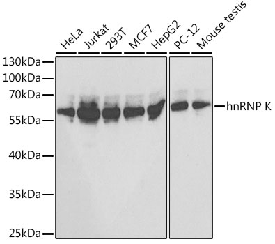 hnRNP K Polyclonal Antibody
