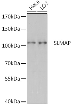 SLMAP Polyclonal Antibody