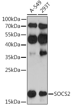 SOCS2 Polyclonal Antibody