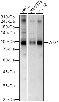 WFS1 Polyclonal Antibody