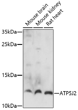 ATP5J2 Polyclonal Antibody