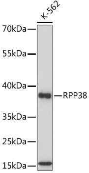 RPP38 Polyclonal Antibody