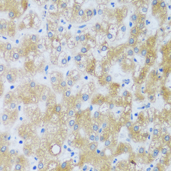 ASB4 Polyclonal Antibody
