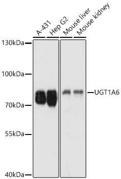 UGT1A6 Polyclonal Antibody