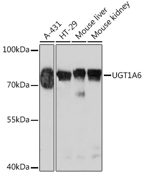 UGT1A6 Polyclonal Antibody