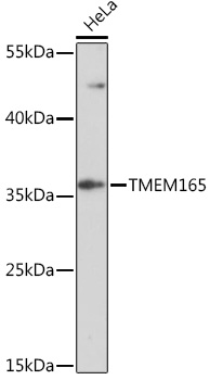 TMEM165 Polyclonal Antibody