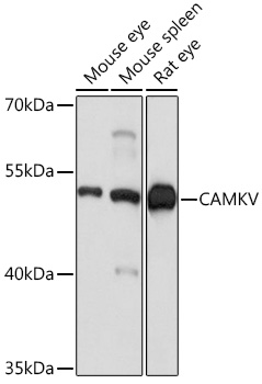 CAMKV Polyclonal Antibody