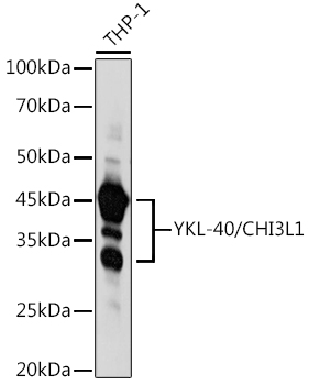 YKL-40/CHI3L1 Polyclonal Antibody