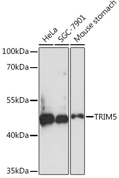 TRIM5 Polyclonal Antibody