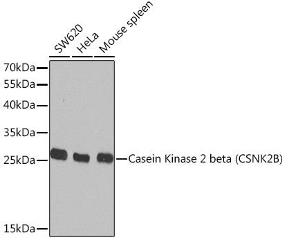 Casein Kinase 2 beta (CSNK2B) Polyclonal Antibody