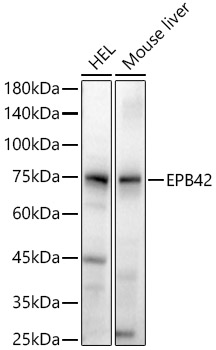 EPB42 Polyclonal Antibody