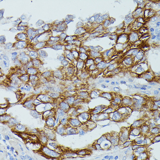 FCGR1B Polyclonal Antibody
