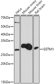GSTM1 Polyclonal Antibody