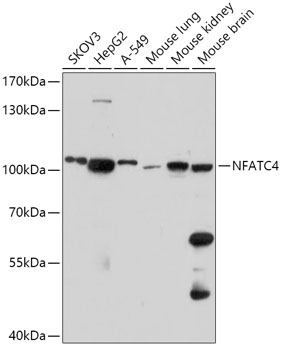 NFATC4 Polyclonal Antibody