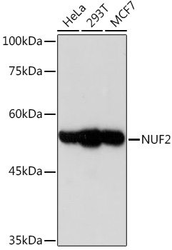 NUF2 Monoclonal Antibody [5J0T9]