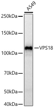 VPS18 Monoclonal Antibody [1W8T9]