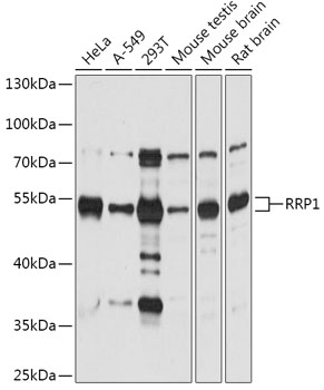 RRP1 Polyclonal Antibody