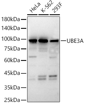 UBE3A Polyclonal Antibody