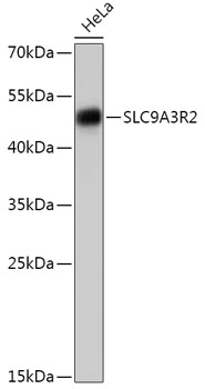 SLC9A3R2 Polyclonal Antibody