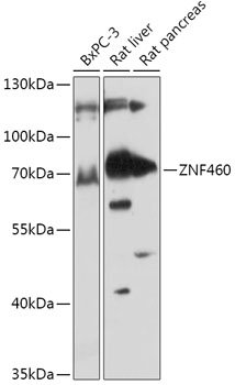 ZNF460 Polyclonal Antibody
