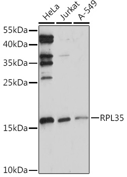 RPL35 Polyclonal Antibody