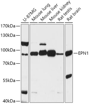 EPN1 Polyclonal Antibody