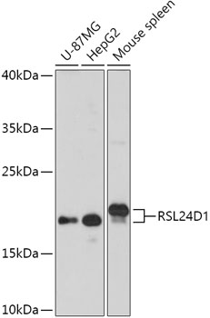 RSL24D1 Polyclonal Antibody