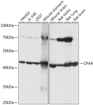CPA4 Polyclonal Antibody