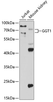 GGT1 Polyclonal Antibody