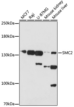 SMC2 Polyclonal Antibody