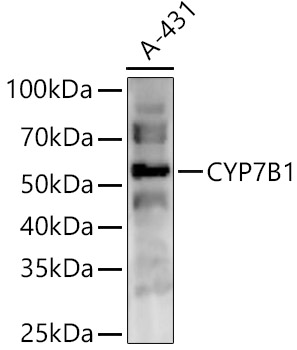 CYP7B1 Polyclonal Antibody