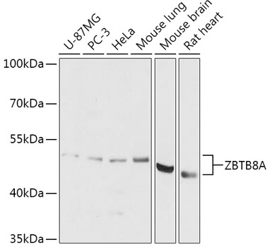 ZBTB8A Polyclonal Antibody