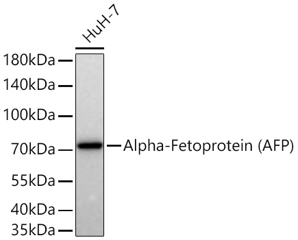 Alpha-Fetoprotein (AFP) Monoclonal Antibody