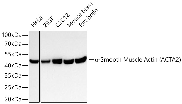 a-Smooth Muscle Actin (ACTA2) Monoclonal Antibody [2V4L9]&nbsp;<img src="images/icon_newarrival.gif" alt="new" border="0">
