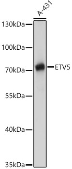 ETV5 Polyclonal Antibody