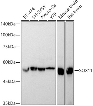 SOX11 Polyclonal Antibody