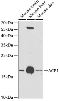 ACP1 Polyclonal Antibody&nbsp;<img src="images/icon_newarrival.gif" alt="new" border="0">