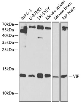 VIP Polyclonal Antibody