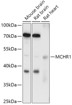 MCHR1 Polyclonal Antibody