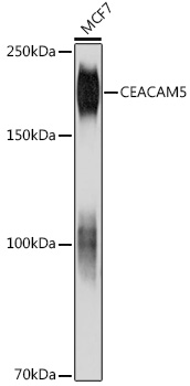 CEACAM5 Monoclonal Antibody [6Y3R3]