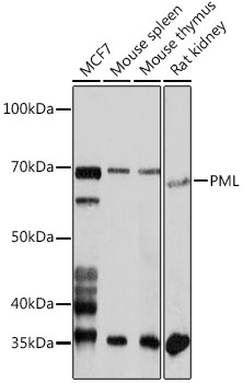 PML Polyclonal Antibody